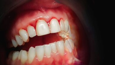 Photo of Liver Disease -ब्रश करते समय कहीं आपके दांतों से भी तो नहीं आ रहा खून खतरनाक बीमारी के हैं लक्षण