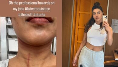 Priyanka Chopra Injured During Shooting: Priyanka Chopra injured on the set of 'The Bluff', called 'occupational hazard'