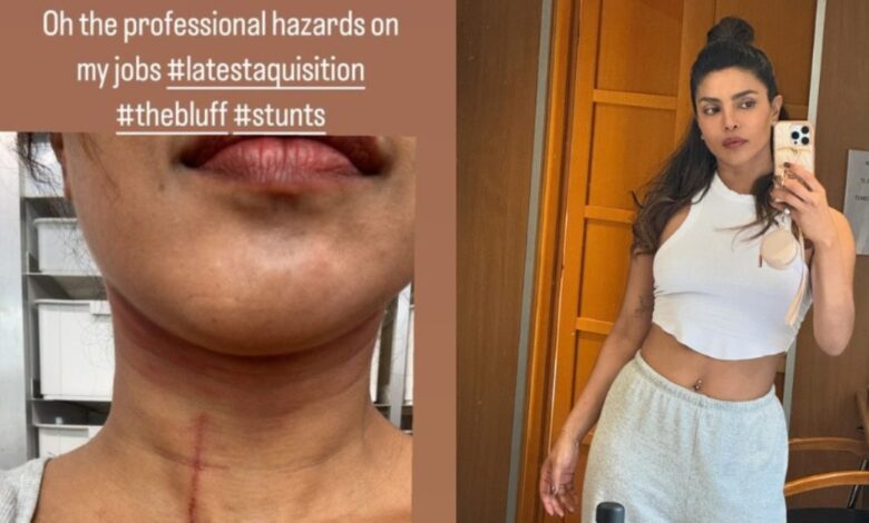 Priyanka Chopra Injured During Shooting: Priyanka Chopra injured on the set of 'The Bluff', called 'occupational hazard'