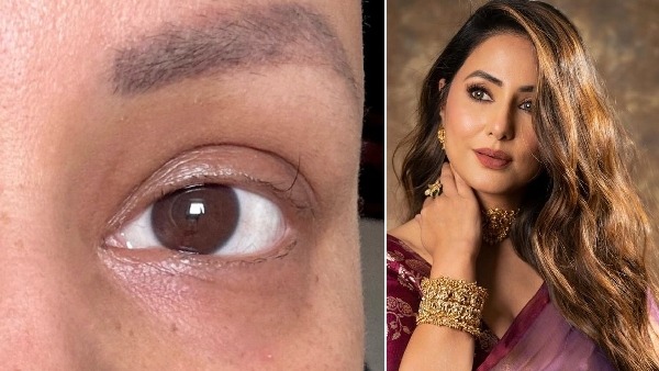 Hina Khan is battling cancer: Hina Khan is battling cancer, even her eyelashes have lost hair