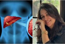 Deepika Kakkar Stage-2 liver Cancer: How dangerous is stage-2 liver cancer? Can life be saved? Know important things related to Deepika Kakkar's condition