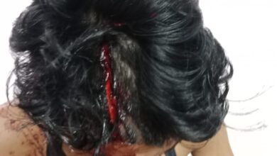 Prayagraj news: Two brothers attacked with sword and knife, one in critical condition