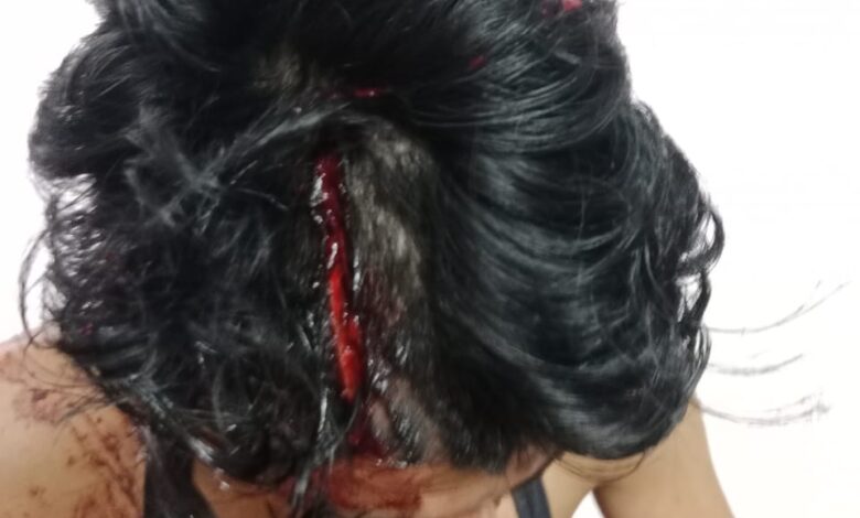 Prayagraj news: Two brothers attacked with sword and knife, one in critical condition