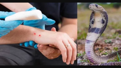 Sultanpur: Do not panic if you get bitten by a snake, get the right treatment immediately – Dr. K. Tripathi, Aastha Hospital