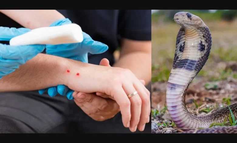 Sultanpur: Do not panic if you get bitten by a snake, get the right treatment immediately – Dr. K. Tripathi, Aastha Hospital