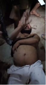 Pratapgarh news: Jansatta Dal worker and Vice President of Vyapar Mandal beaten up, case registered under serious sections