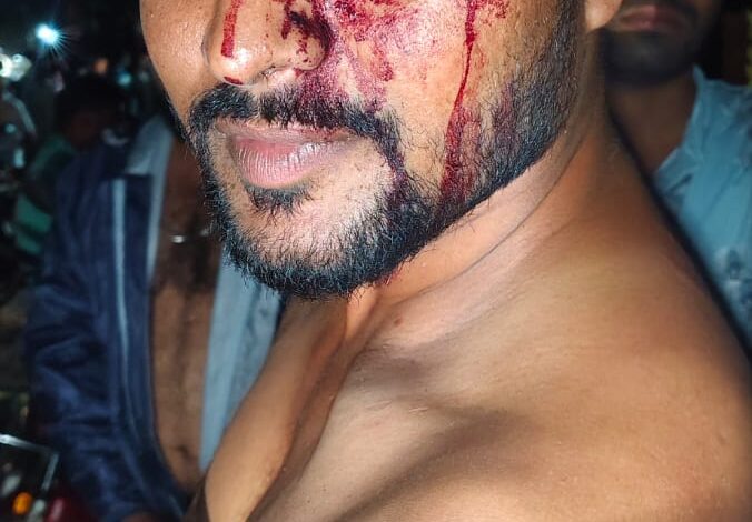Sonbhadra news: Murderous attack on Durga Puja committee president, two accused arrested