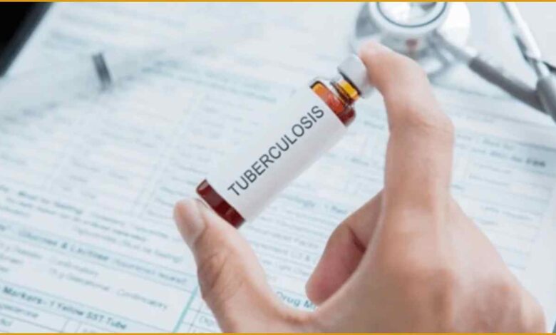 टीबी भारत रिपोर्ट, RTI टीबी खुलासा, TB cases India 2025, National TB Elimination Programme, तपेदिक मरीज आंकड़े, TB in Uttar Pradesh, India health mission failure,  टीबी उन्मूलन लक्ष्य, TB rise in India, NTEP India data