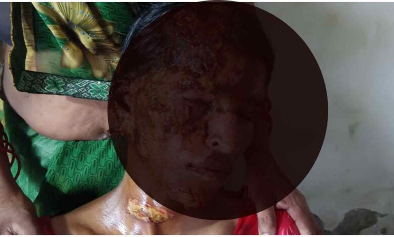पीलीभीत, बरखेड़ा, विवाहिता, महिला उत्पीड़न, घरेलू हिंसा, पेट्रोल हमला, क्राइम न्यूज, उत्तर प्रदेश, एफआईआर, पुलिस जांच, शाहजहांपुर, महिला सुरक्षा, पीलीभीत विवाहिता पेट्रोल हमला, पीलीभीत समाचार, विवाहिता पर पेट्रोल हमला, घरेलू हिंसा मामला, बरखेड़ा थाना, पीलीभीत क्राइम न्यूज, दहेज प्रताड़ना, महिला उत्पीड़न, यूपी क्राइम न्यूज, शाहजहांपुर ससुराल विवाद, एफआईआर की मांग